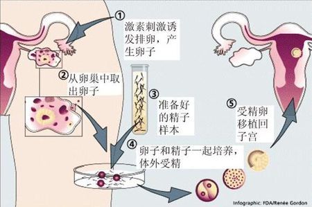 关于爱心拉拉代怀咨询怎么选